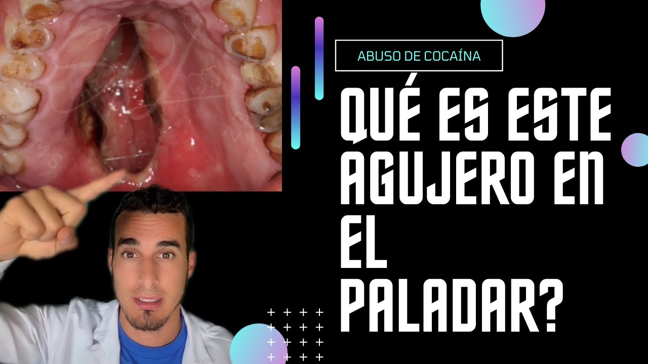en un conductor el consumo de anfetaminas...