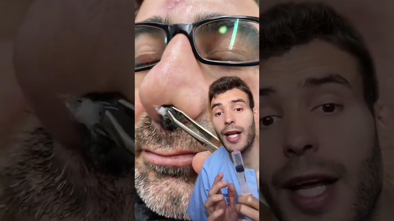 si mi padre es autónomo me dan beca